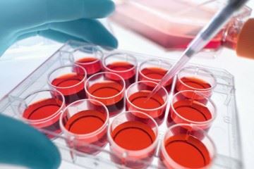 تغییر سیاست سازمان انتقال خون در اهدای پلاسما