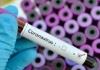 مثبت شدن آزمایشات اولیه دو مورد مشکوک به کروناویروس