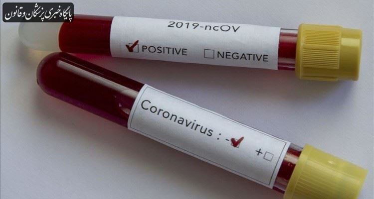 آموزش تشخیص ویروس کرونا به تمامی آزمایشگاه‌های کشور