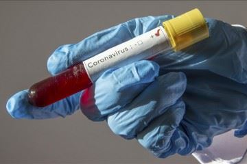 ابتلای مجدد بیمار بهبود یافته کروناویروس در ژاپن