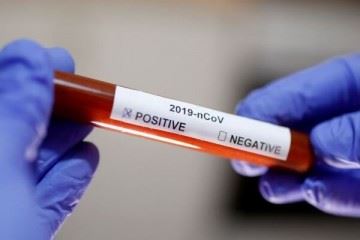 آمار جهانی مبتلایان به کروناویروس از ۱۰۰ هزار نفر گذشت