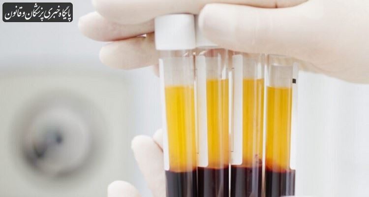 از پلاسمای خون بهبودیافتگان برای درمان بیماران مبتلا به کرونا و ویروس استفاده شود