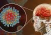 سکته مغزی ۲۵ مبتلا به ویروس کرونا در بیمارستان شهدای تجریش