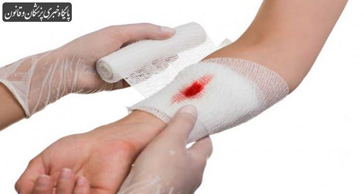 آیا ویروس کرونا از راه زخم وارد بدن میشود؟ آیا ویروس کرونا از راه زخم وارد بدن میشود؟
