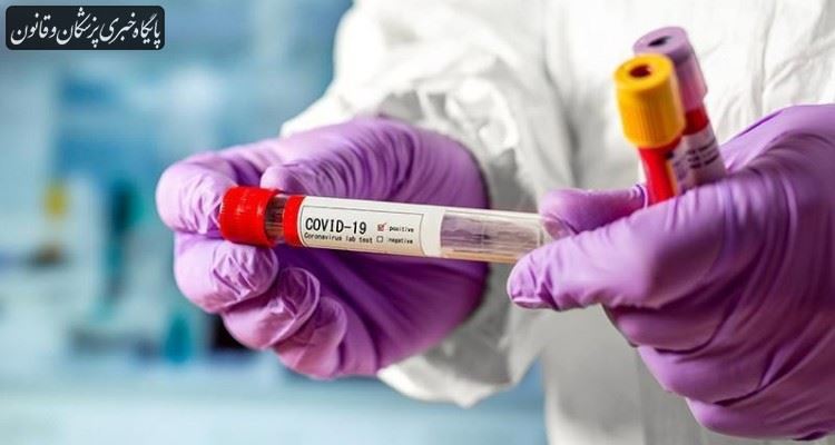 بهترین راه تشخیص ویروس کرونا، تستهای مولکولی (PCR) است بهترین راه تشخیص ویروس کرونا، تستهای مولکولی (PCR) است