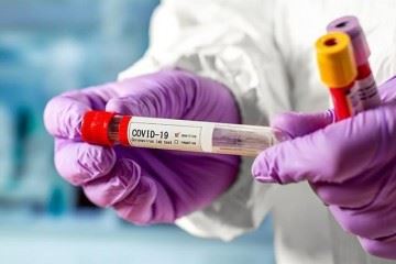 بهترین راه تشخیص ویروس کرونا، تست‌های مولکولی (PCR) است