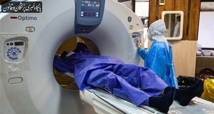 سی تی اسکن ریه فقط باید برای بیماران کرونایی با شرایط حاد انجام شود سی تی اسکن ریه فقط باید برای بیماران کرونایی با شرایط حاد انجام شود
