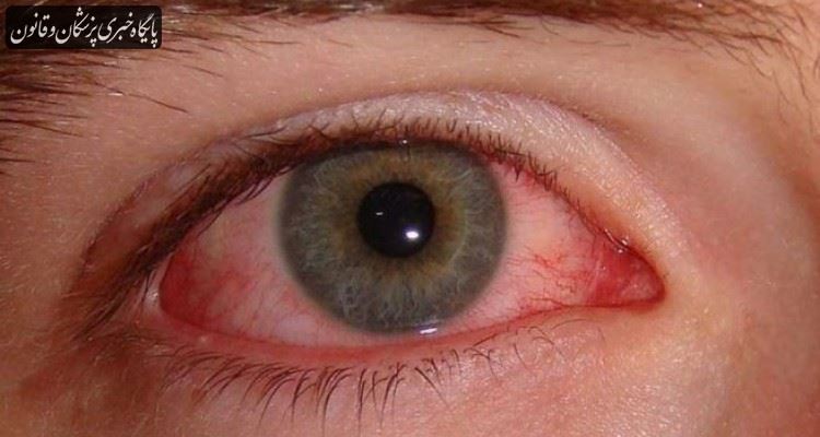 معاینه تغییرات حاد در چشم‌ها را به دلیل بیماری کرونا به تعویق نیاندازید