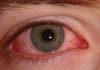 معاینه تغییرات حاد در چشم‌ها را به دلیل بیماری کرونا به تعویق نیاندازید