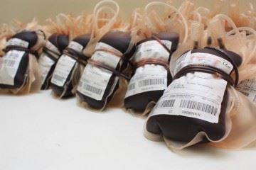 بهبودیافتگان کرونا جهت اهدای پلاسما به مراکز انتقال خون مراجعه کنند