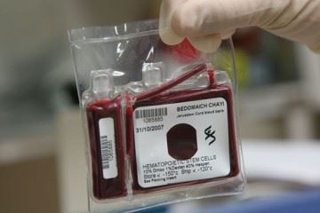 انجام ۱۷ مورد موفق پیوند با استفاده از سلول‌های خون بند ناف در کشور