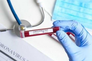 انتشار گزارش گاه‌نگار اپیدمیولوژی بیماری کرونا