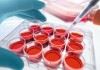 تاکنون بیش از ۱۲ هزار پیوند سلول‌های بنیادی خون‌ساز در کشور انجام شده است