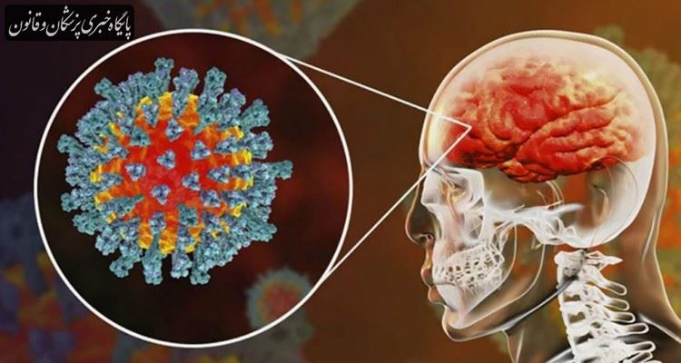 همراهی سکته مغزی با ویروس کرونا یکی از مهمترین عارضه‌های این ویروس است