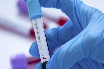 تست کرونا ممکن است ویروس مرده را بیماری‌زا تشخیص دهد
