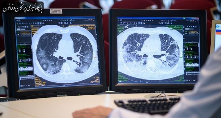 افزایش ۲۵۰ درصدی سی‌تی‌اسکن ریه در بیمارستان‌های دانشگاه‌های علوم پزشکی