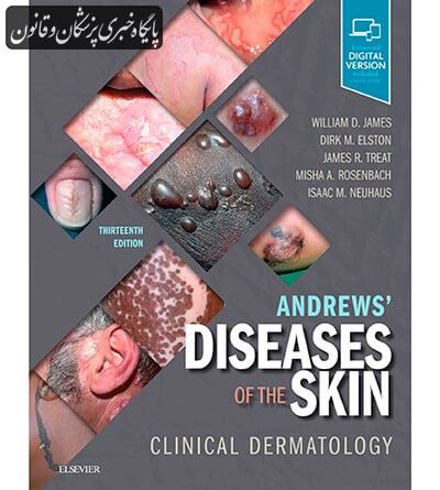 Andrews' Diseases of the Skin: Clinical Dermatology