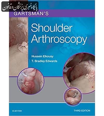 Gartsman's Shoulder Arthroscopy