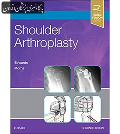 Shoulder Arthroplasty