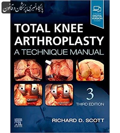 Total Knee Arthroplasty