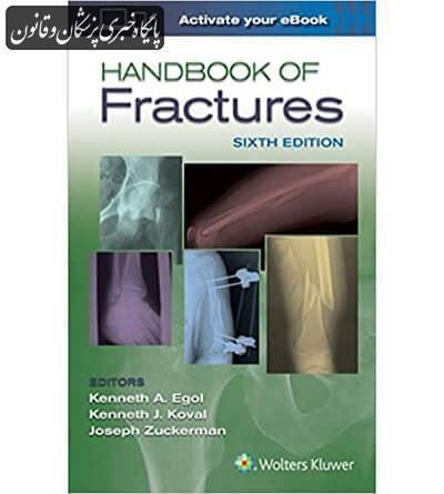 Handbook of Fractures