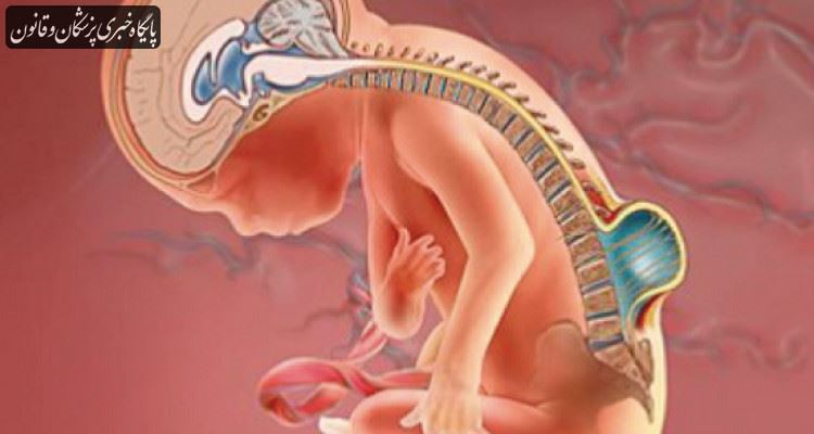 برگزاری همایش ملی ناهنجاری های مادرزادی در مشهد برگزاری همایش ملی ناهنجاری های مادرزادی در مشهد