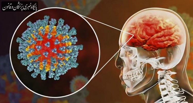 افراد مبتلا به کرونا علائم مختلف عصبی را ممکن است داشته باشند افراد مبتلا به کرونا علائم مختلف عصبی را ممکن است داشته باشند