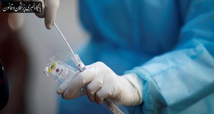از لحاظ اپیدمیولوژیک شرایط مناسبی برای انجام تست PCR انبوه نداریم از لحاظ اپیدمیولوژیک شرایط مناسبی برای انجام تست PCR انبوه نداریم
