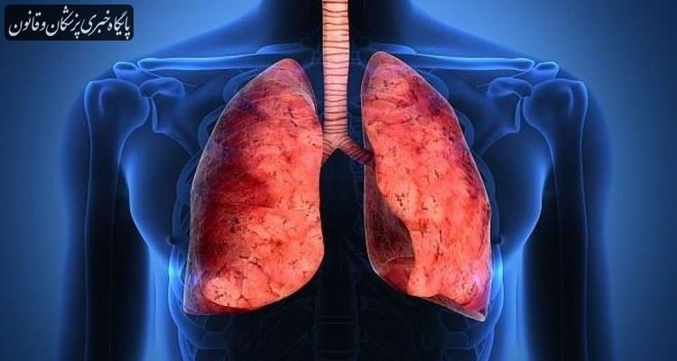  آنچه در تقویت سیستم ایمنی ریه نقش پر رنگی دارد حفاظت اولیه است آنچه در تقویت سیستم ایمنی ریه نقش پر رنگی دارد حفاظت اولیه است