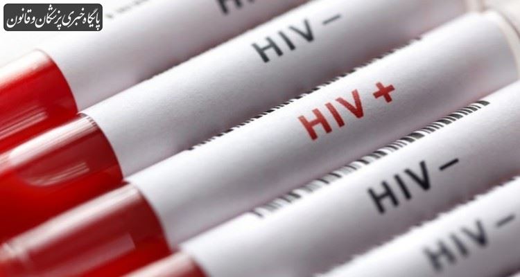تعداد مردان مبتلا به HIV در ایران بیشتر است
