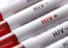 تعداد مردان مبتلا به HIV در ایران بیشتر است