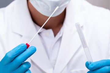 انجام آزمایش کرونا با تست تشخیص سریع رایگان است