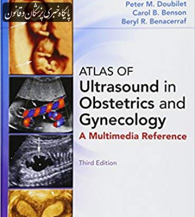 ATLAS OF ultrasound in obstetrics and gynecoligy