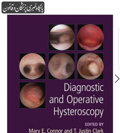 Diagnostic and operative hysteroscopy