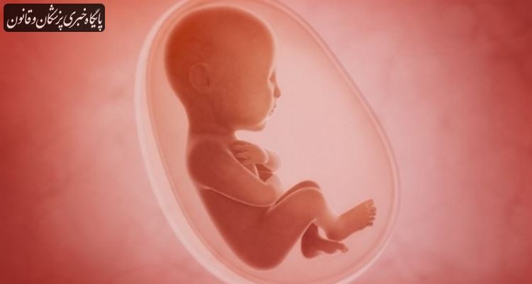 علل سقط مکرر جنین
