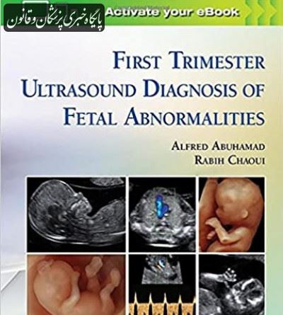 First Trimester Ultrasound Diagnosis of Fetal Abnormalities