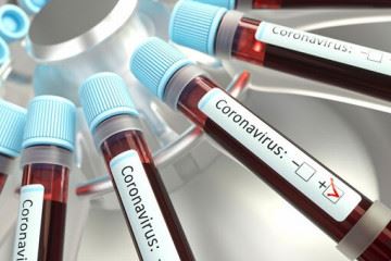 کیت آنتی ژن تشخیص جهش یافته ویروس کرونا توسط ستاد اجرایی فرمان امام تولید شد