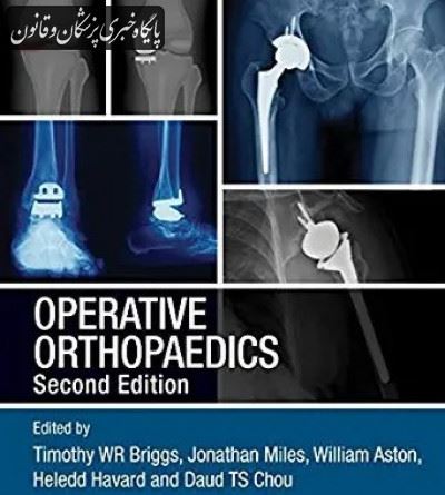 OPERATIVE ORTHOPAEDICS