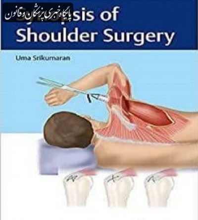 Synopsis of Shoulder Surgery