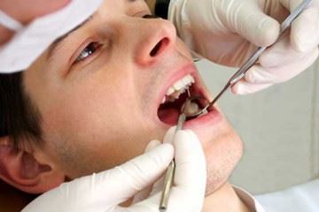 ۹۰ درصد مردم مشکلات دهان و دندان دارند