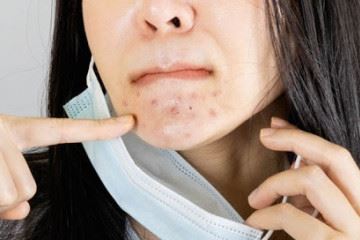 راهکارهایی برای کاهش عوارض پوستی ناشی از ماسک‌های تنفسی