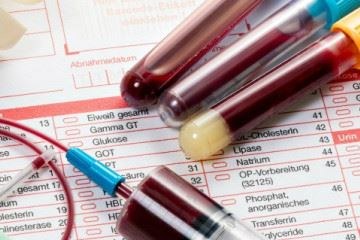 تشخیص زودهنگام احتمال ابتلا به نوعی سرطان خون با آزمایش ژنتیک