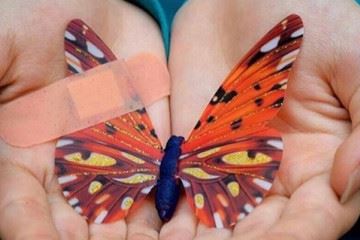 یونیسف پانسمان مورد نیاز  بیماران پروانه‌ای را تا یکسال آینده تامین کرده است