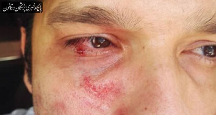 کتک زدن کارشناس بهداشت در تنگستان کتک زدن کارشناس بهداشت در تنگستان