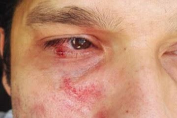 کتک زدن کارشناس بهداشت در تنگستان