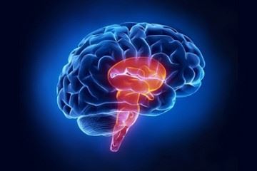 سکته مغزی از شایعترین بیماری های مغز و اعصاب است