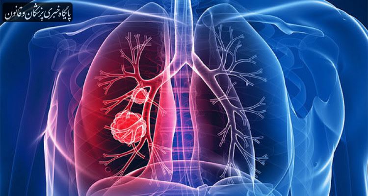 سالیانه ۱۱۰ هزار مورد ابتلا به سرطان در کشور شناسایی می‌شود