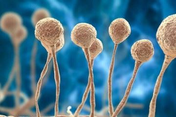 قارچ سیاه در افرادی که دارای نقص ایمنی بدن هستند بروز می کند