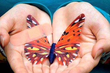 تولید زخم‌پوش‌هایی برای درمان بیماری پروانه‌ای
