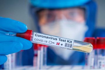 فهرست جدید آزمایشگاه های تشخیص کووید ۱۹